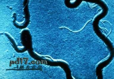 世界上最危险的细菌：Top10 - 一起盘点网