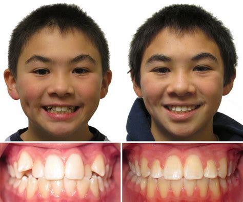 Kids Dentist in KPHB, Kukatpally, Hyderabad - Best Dental Clinic for ...