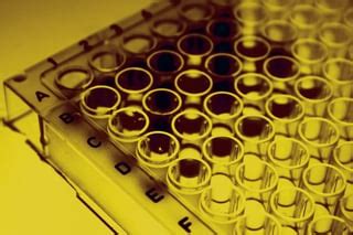 Image result for Elisa Protocol Blocking Buffer