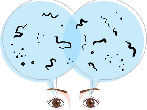 What Are Eye Floaters? | Vision Problems | Eye Health