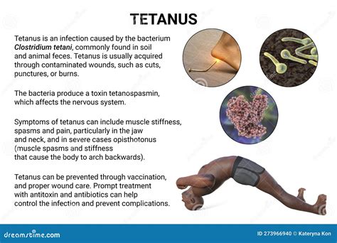Mechanism of Tetanus Disease, 3D Illustration Stock Illustration - Illustration of disease ...