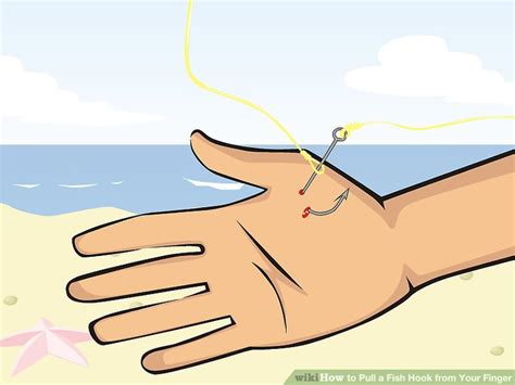 Image result for String Pull Method Fish Hook Removal
