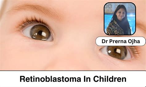 Recognizing Retinoblastoma Symptoms: Eye cancer in children