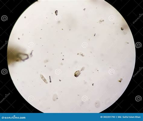 Schistosoma Mansoni Parasites Under The Microscope. Royalty-Free Stock ...