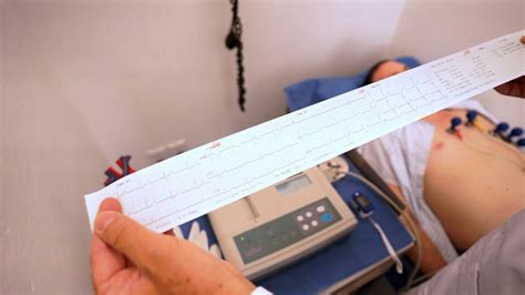 Cardiogram Procedure 的图像结果