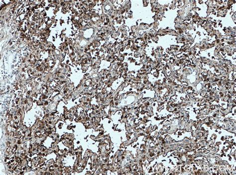 Surfactant Protein A antibody (11850-1-AP) | Proteintech