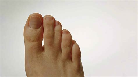 Why Does My Baby Has Webbed Toes - Southern California Foot & Ankle Specialists