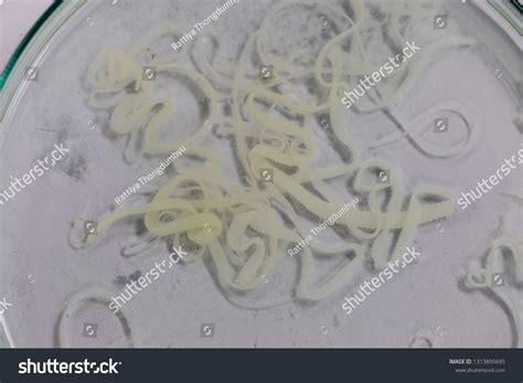 Does Freezing Kill Tapeworm Eggs: A Complete Guide To Safety