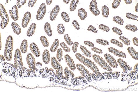 BTG2 antibody (22339-1-AP) | Proteintech