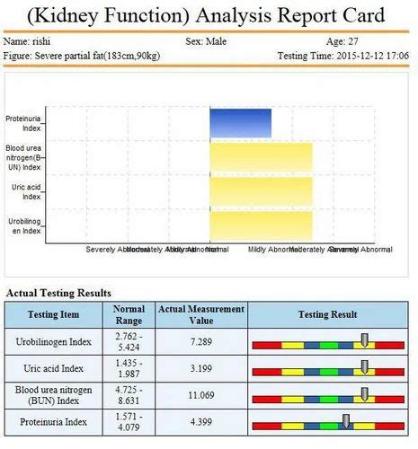 quantum resonance magnetic analyzer importer - 32G+ 32th Generation ...