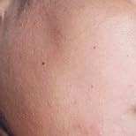 Nuskhe By Paras | AM PM Pigmentation Combo |Deep Hydration | Day ...