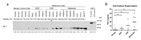 Tumour Progression Stage-Dependent Secretion of YB-1 Stimulates ...