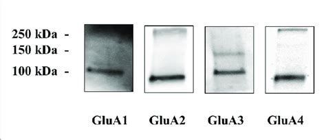 Image result for Glua4 Neuron