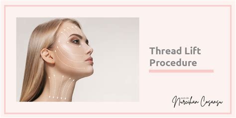 Image result for Thread Lift Procedure YouTube