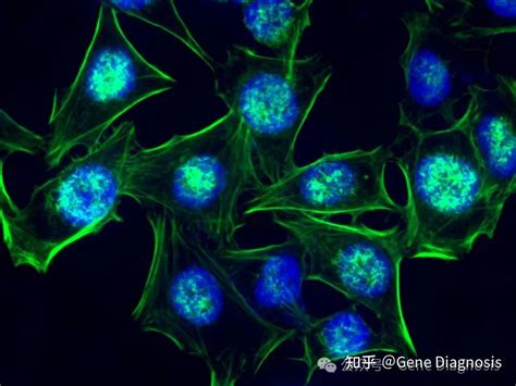 Chest Colorizer 的图像结果