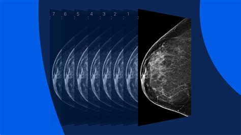 2D vs 3D mammogram: How they compare and what to expect