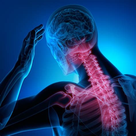 HWS-Syndrom Schwindel 的图像结果