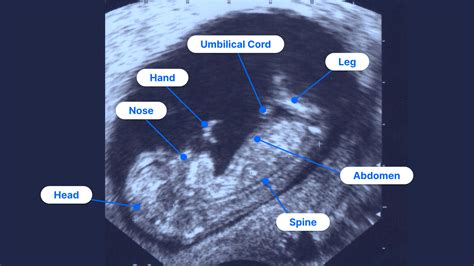 How to Read an Ultrasound: Colors, Numbers and Abbreviations