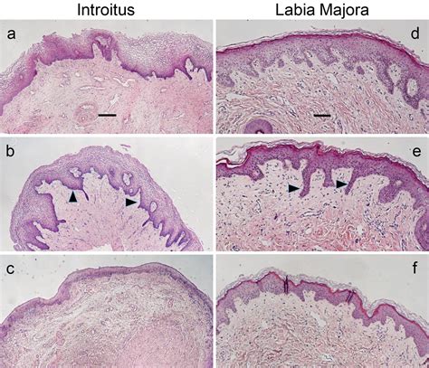Histological and Gene Expression Analysis of the Effects of Menopause Status and Hormone Therapy ...