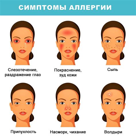 Как распознать симптомы аллергии на пыльцу и справиться с ними весной ...