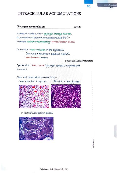 05 Pathology: Intracellular Accumulations and Cellular Aging Notes ...