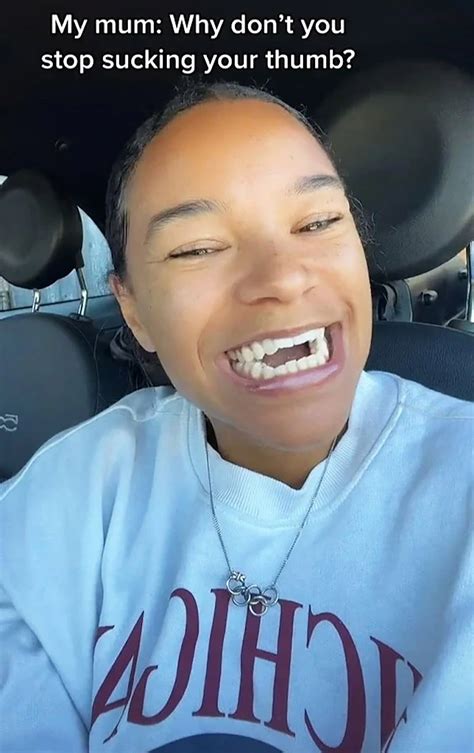 I’m an Olympian who sucks her thumb — and my teeth are crooked