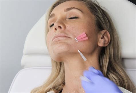 Image result for Cheek Threads