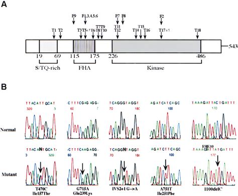 Mutations in CHEK2 Associated with Prostate Cancer Risk: The American ...