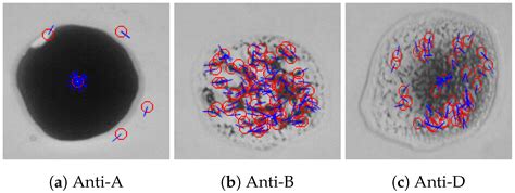 An Efficient System for Automatic Blood Type Determination Based on ...