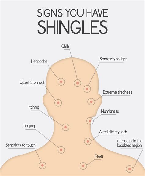 What Is Shingles: Causes, Symptoms and Contagiousness – The Amino Company
