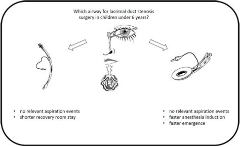 Laryngeal Mask Airway Versus Endotracheal Intubation during Lacrimal ...