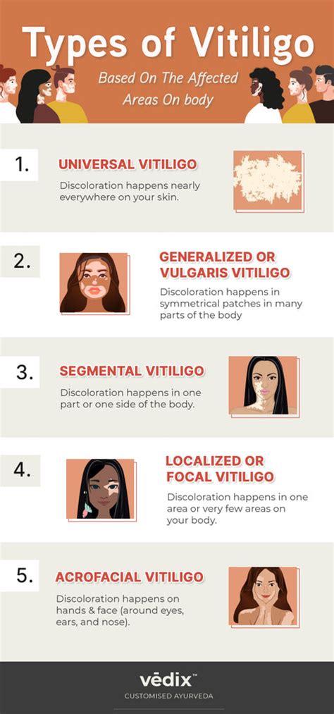 How To Identify & Cure Vitiligo Through Ayurveda? – Vedix