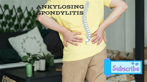 Ankylosing spondylitis pronunciation/How to pronounce Ankylosing ...