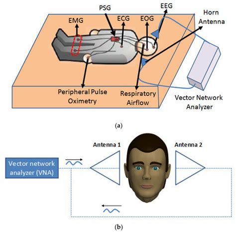 A Novel Microwave Treatment for Sleep Disorders and Classification of ...