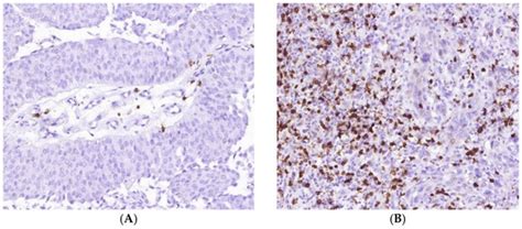 Cells | Special Issue : Tumor Immune Microenvironment for Effective Therapy