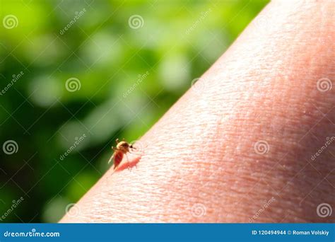 Blood-sucking Insect on Human Skin. Mosquito Full of Blood Close-up ...
