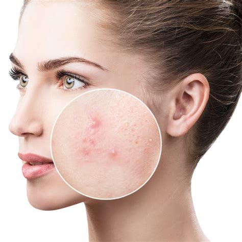 Benefits & Uses of Argan Oil