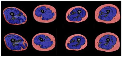 Convolutional Neural Network-Based Automated Segmentation of Skeletal ...