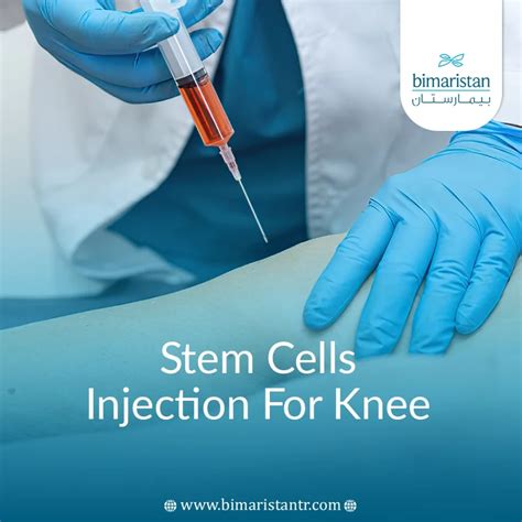 Stem Cell Injection 的图像结果