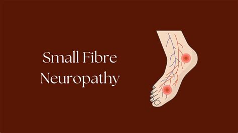 Shared post - Understanding Small Fibre Neuropathy