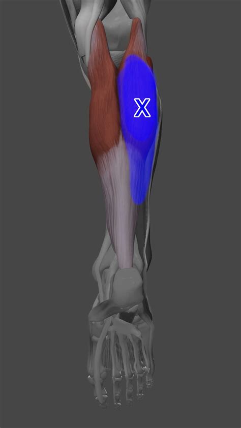 Soleus Muscle Pain
