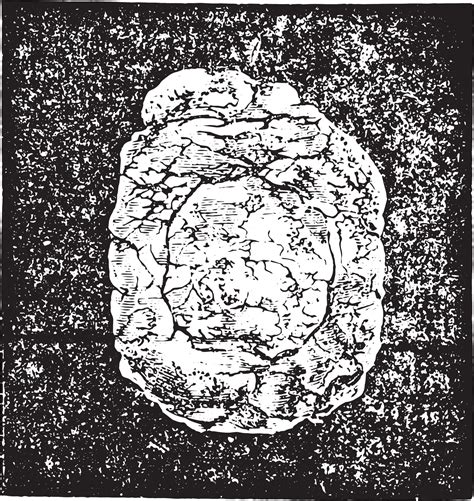 Calculation of sodium urate enchatonn in the bladder mucosa and 35068003 Vector Art at Vecteezy