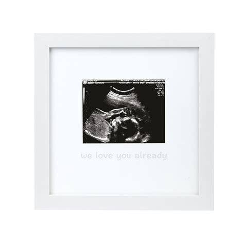 Tiny Ideas We Love You Already Sonogram Keepsake Photo Frame, White ...