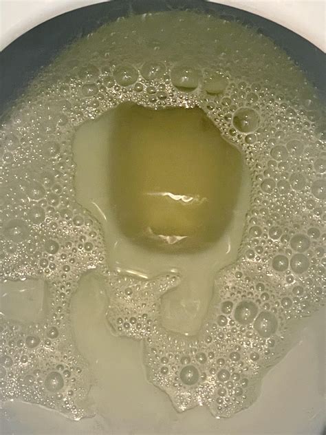 Foam In You Pee at Rita Skelley blog