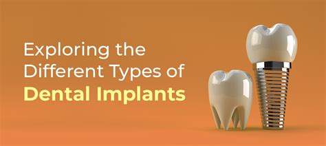 Image result for Different Types of Teeth Implants