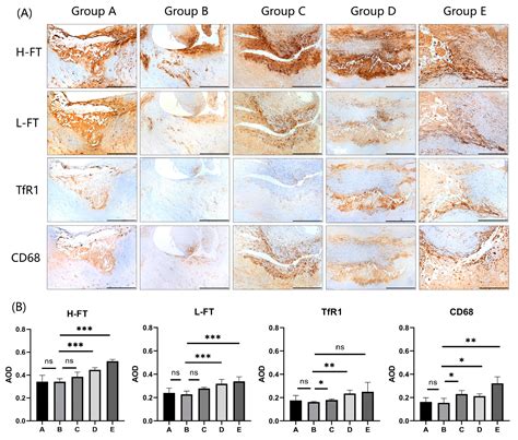 The Relation of the Iron Metabolism Index to the Vulnerability Index of ...