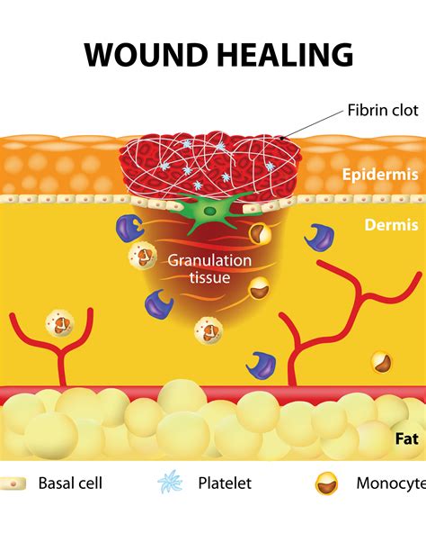 Horse Wound Healing Stages Pictures at Harlan Rockwood blog