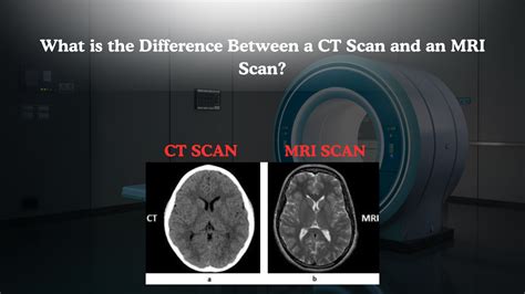 What is the Difference Between a CT Scan and an MRI Scan? - Book My MRI