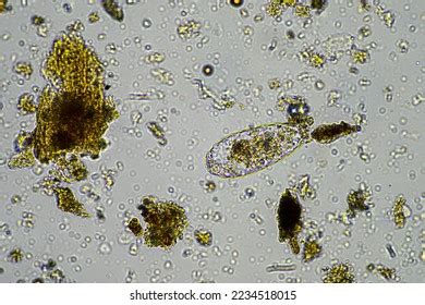 Scalp Parasites 的图像结果