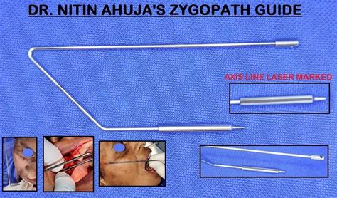 Image result for Light Design Guide Rod